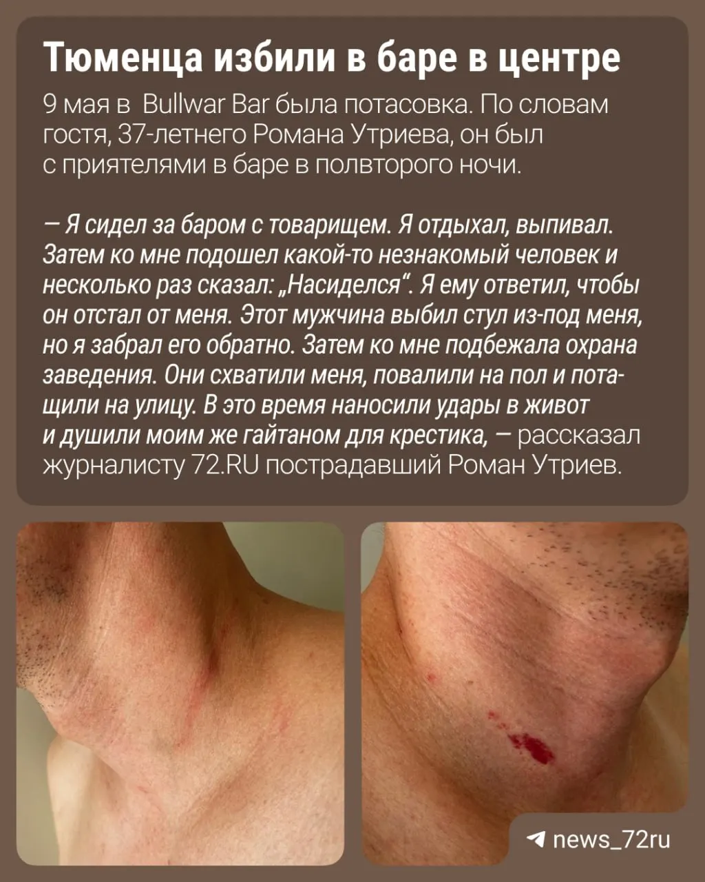 По словам посетителя, после спора из‑за стула сотрудники охраны вывели и выкинули его из заведения. Бар от комментариев отказался, полиция проводит проверку.