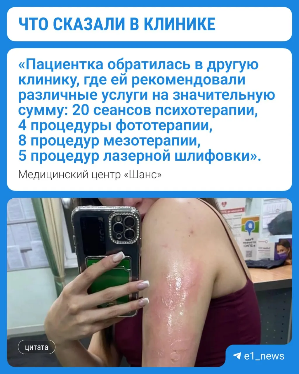 В медцентре заявили, что женщине стало плохо и она прилегла на кушетку, после чего обожглась о батарею. Ей оказали обработку и консультации, заключение судмедэкспертизы пациентка пока не предоставила.