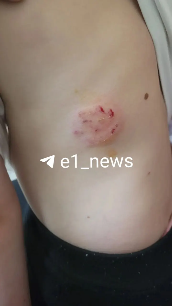 В Октябрьском районе собака без намордника напала на ребёнка. Семья обратилась в полицию и в больницу, мать просит сообщить сведения о прививках животного.