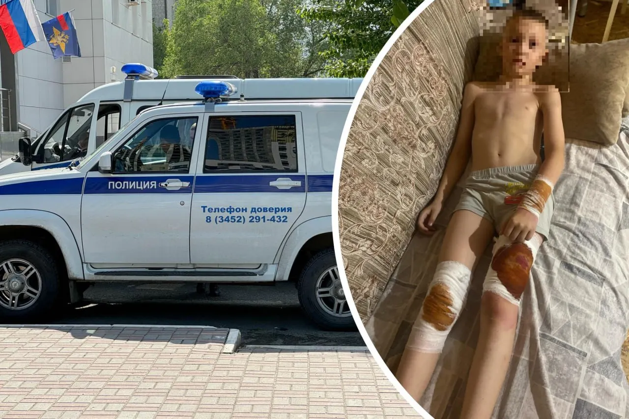 В тюменском садовом товариществе бойцовская собака набросилась на ребёнка; по словам соседей, ранее по этой собаке уже поступали жалобы в полицию. По факту инцидента проводится проверка.