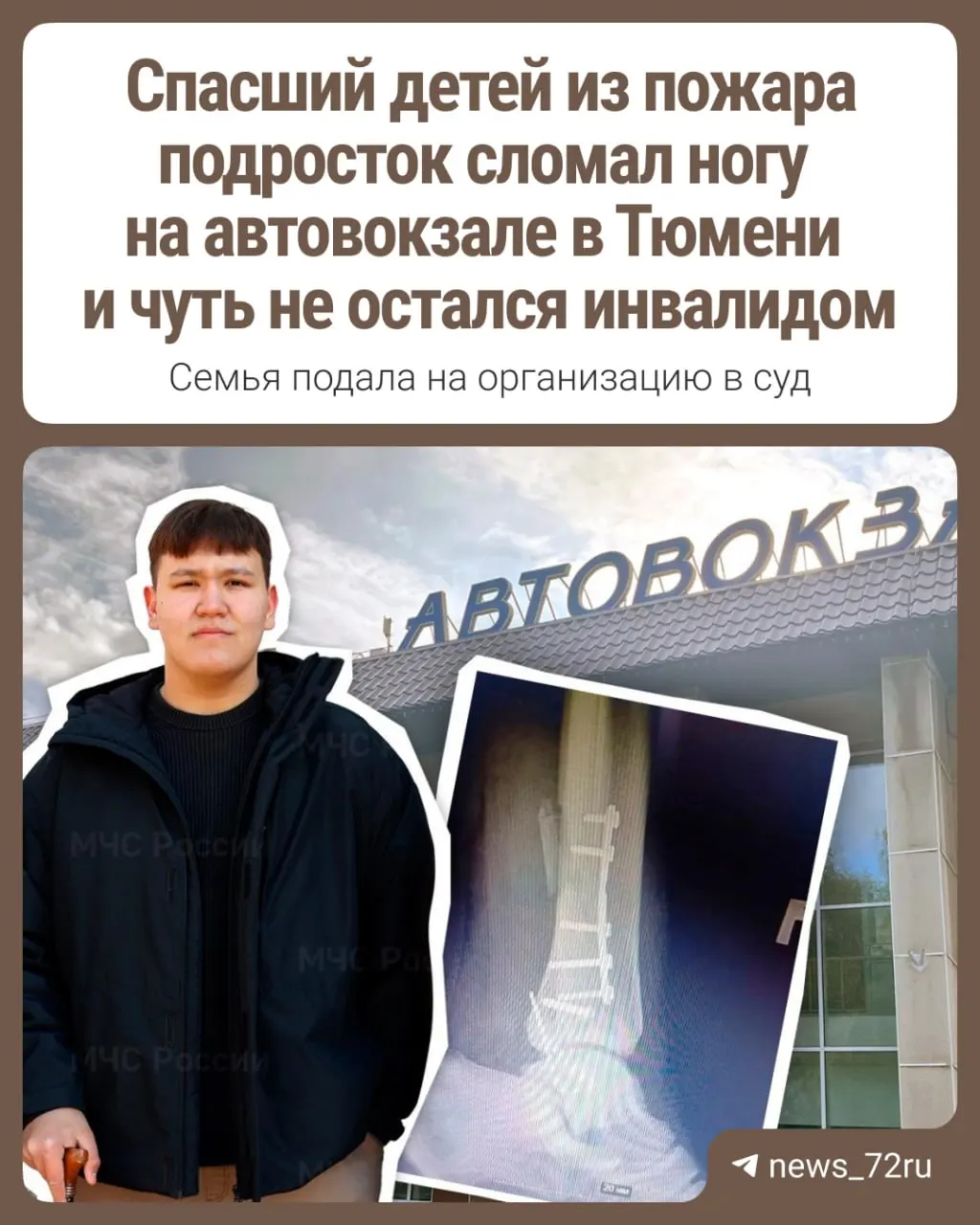 Семья Диляры и Айдара из Тюменской области подала иск к городскому автовокзалу после того, как их сын получил травму на льду у перрона. Суд вынес решение о выплате, но деньги до сих пор не поступили.