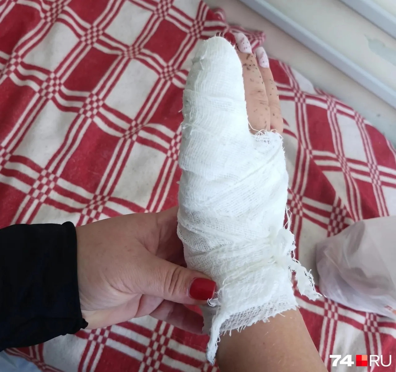 Девочка получила травму пальца во дворе на спортивном тренажёре; мама сообщила о тяжёлом восстановлении и необходимости проверки оборудования.