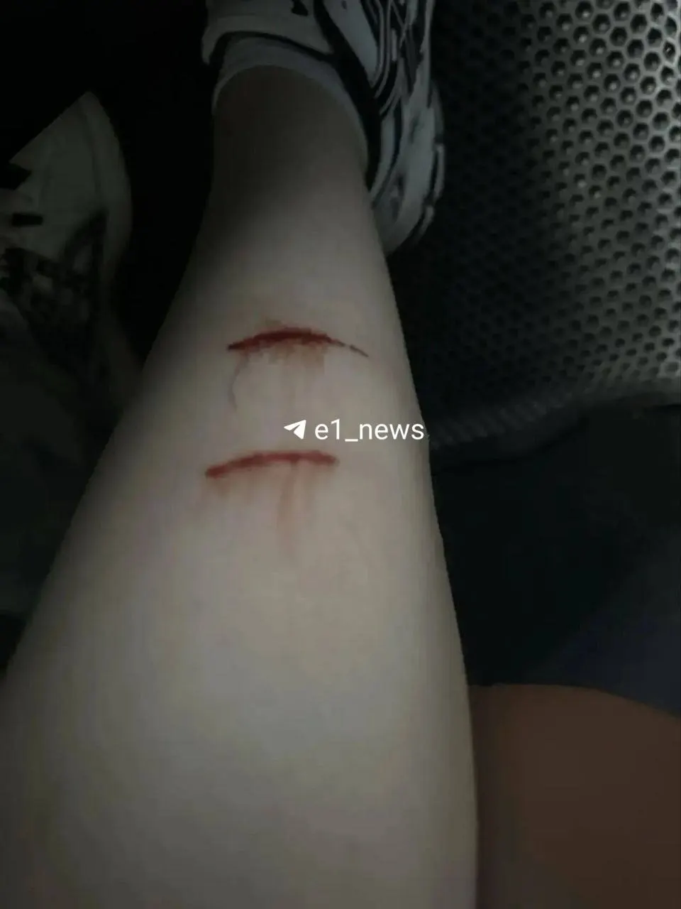 В Екатеринбурге на улице Европейской 16-летняя девушка была атакована стаей бродячих собак. Прохожий Евгений сопроводил пострадавшую в больницу, пока не прибыли родственники; пострадавшая получила медицинскую помощь и прививку.